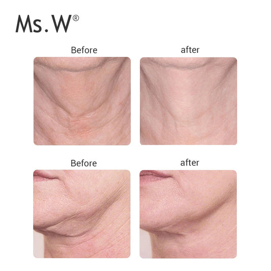 313 Ms.W Home Used Microcurrent Machine for Sale Neck Winkle Remover Weight Loss Body Slimming Beauty Face Neck Lifting Massager