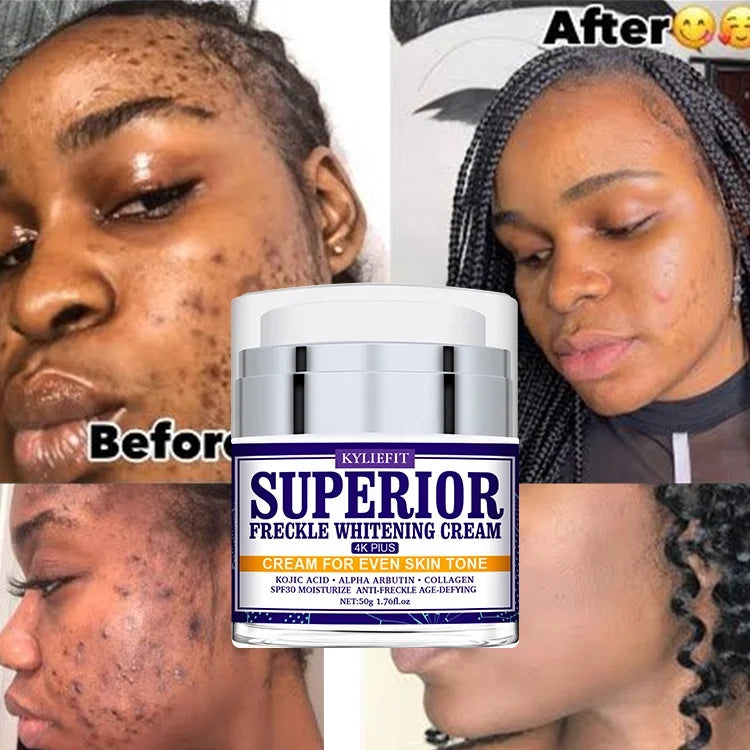 Own Brand Vitamin C Anti-aging and Wrinkles Anti Freckle Black Spots Whitening Face Cream in Saudi Arabia