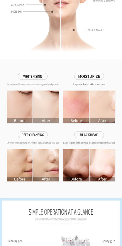 The Latestskin and Eye Multi-function Hydrogen and Oxygen Bubbles,Cleansing and Hydrating Beauty Machine