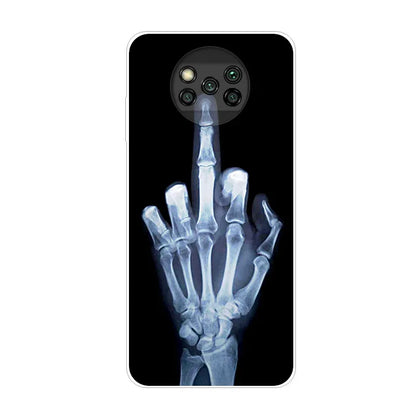 Phone Case For Poco X3 Pro Cover TPU Coque Cool Slim Clear Covers for Xiaomi Poco X3 NFC Case PocX3 X 3 Silicon Funda Cartoon