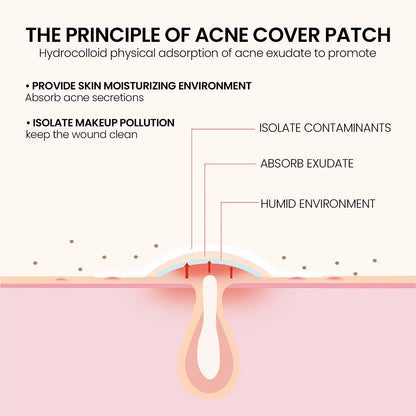 Salicylic Acid Unique Compact Oem Cute Invisible Private Label Custom Design Korean Hydrocolloid Acne Pimple Patches for Face