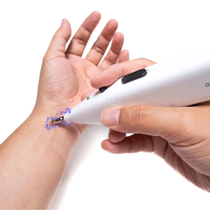 Magical Meridian Acupuncture Pen Sub-health Electric Acupuncture Therapy Device