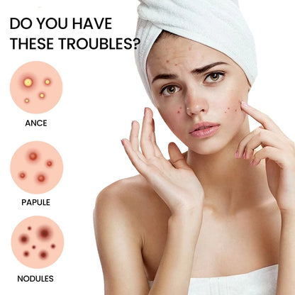 Salicylic Acid Unique Compact Oem Cute Invisible Private Label Custom Design Korean Hydrocolloid Acne Pimple Patches for Face