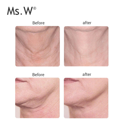 313 Ms.W Home Used Microcurrent Machine for Sale Neck Winkle Remover Weight Loss Body Slimming Beauty Face Neck Lifting Massager