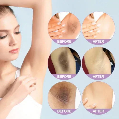 Ouhoe Whitening Serum Can Moisturize Underarm Joint Dullness And Lighten Skin Tone