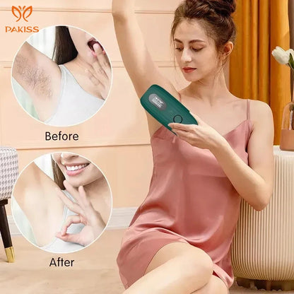 2023 Body Beauty Personal Care Ipl Hair Removal Portable Hair Epilator Diode Laser Ipl Hair Removal