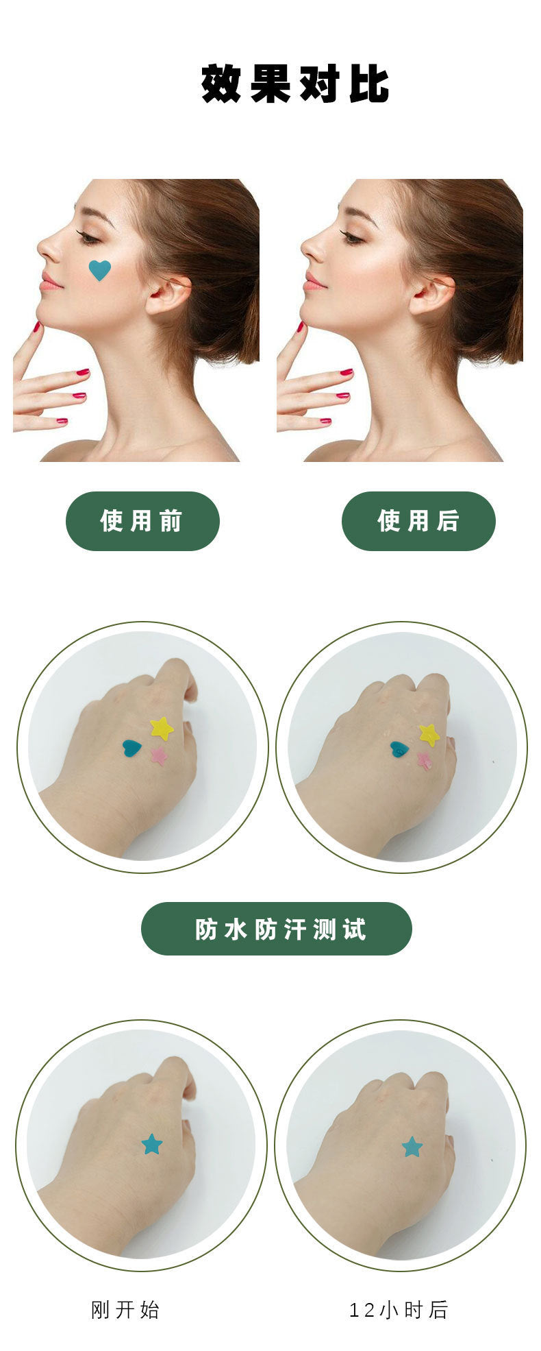 New Star Color Student Acne Colloid Cute Dopamine Anti-Acne Day and Night Lightening Concealer Double-Effect Acne Removal