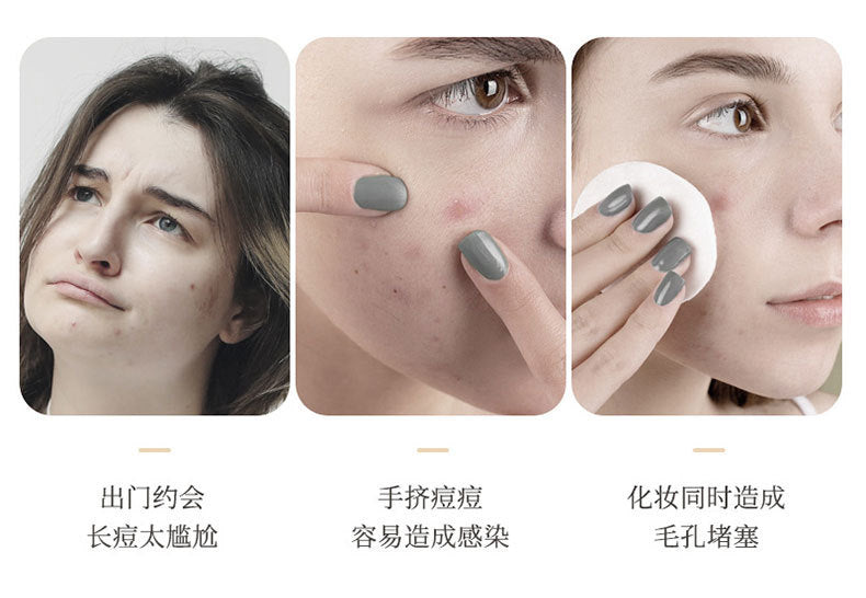 New Star Color Student Acne Colloid Cute Dopamine Anti-Acne Day and Night Lightening Concealer Double-Effect Acne Removal