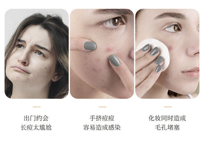 New Star Color Student Acne Colloid Cute Dopamine Anti-Acne Day and Night Lightening Concealer Double-Effect Acne Removal