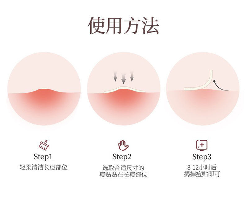 New Star Color Student Acne Colloid Cute Dopamine Anti-Acne Day and Night Lightening Concealer Double-Effect Acne Removal