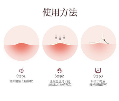 New Star Color Student Acne Colloid Cute Dopamine Anti-Acne Day and Night Lightening Concealer Double-Effect Acne Removal