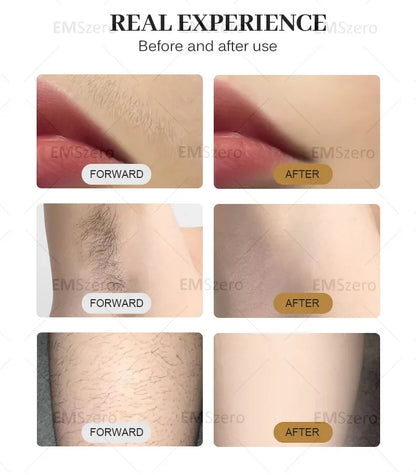 3500W Freezing Point Private Parts Body Face 808nm Diode Laser Hair Removal Machine Multifunction Permanent Painless Epilator