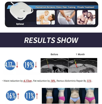 EMSzero HIEMT RF High Intensity Vibration Pulse Electronic Body Shaping Massage Muscle Massage