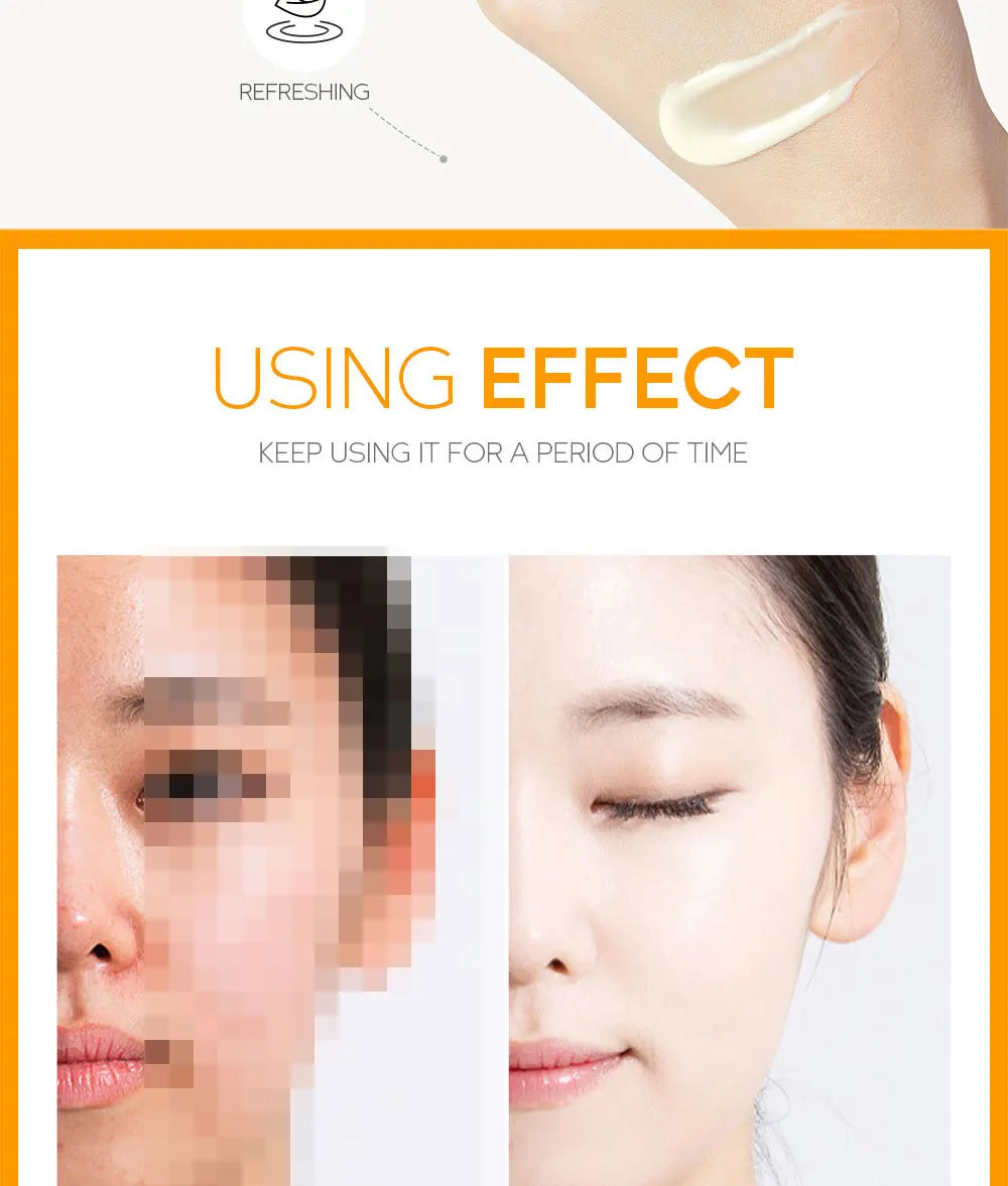 LAIKOU VITAMIN WHITENING CREAM Lightening Repairing Smooth Skincare Whitening Creams