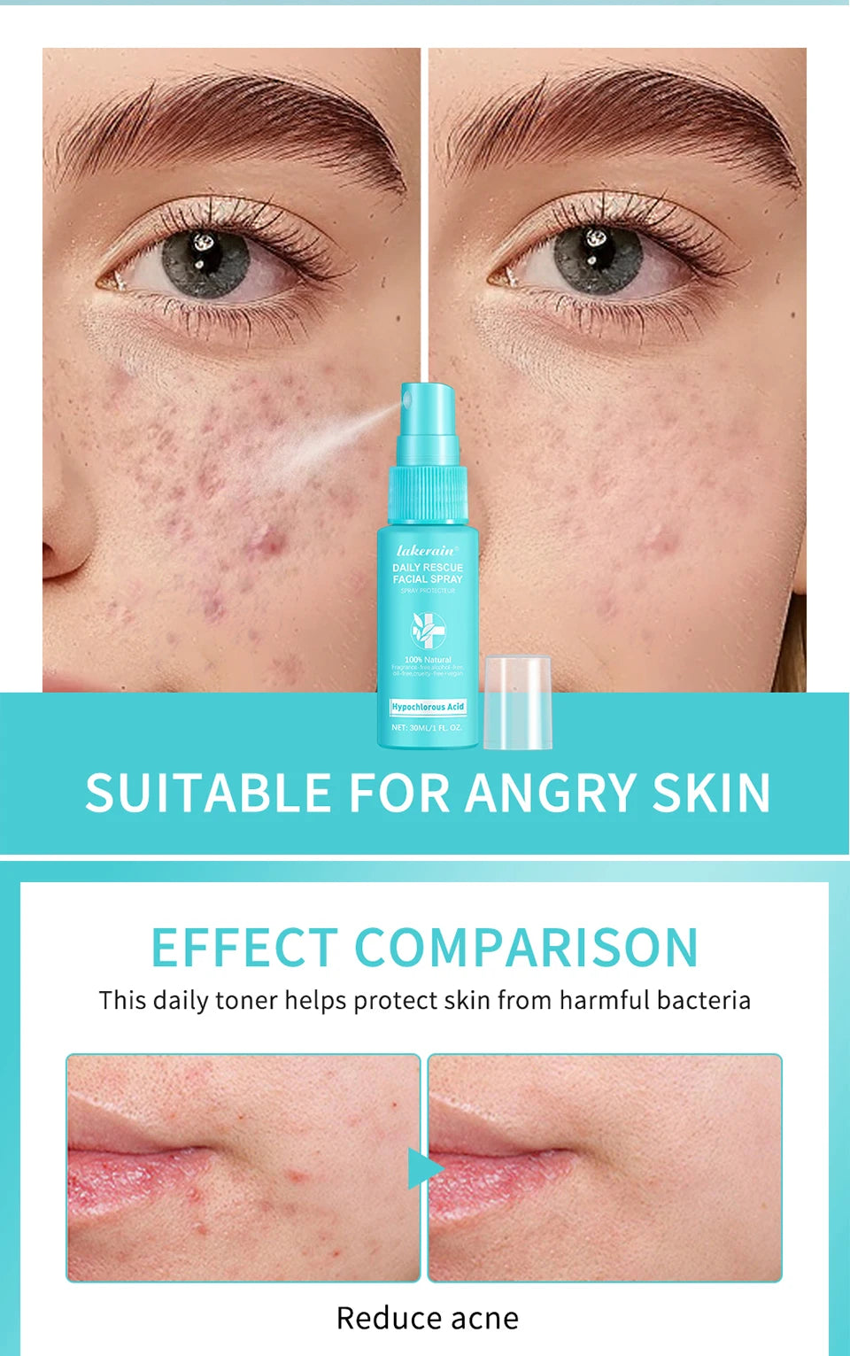 Hypochlorous Acid Spray Toner for Face Helps Reduce Redness Breakouts Soothing pH Balancing Toner Skincare
