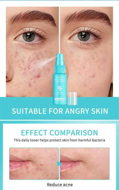 Hypochlorous Acid Spray Toner for Face Helps Reduce Redness Breakouts Soothing pH Balancing Toner Skincare
