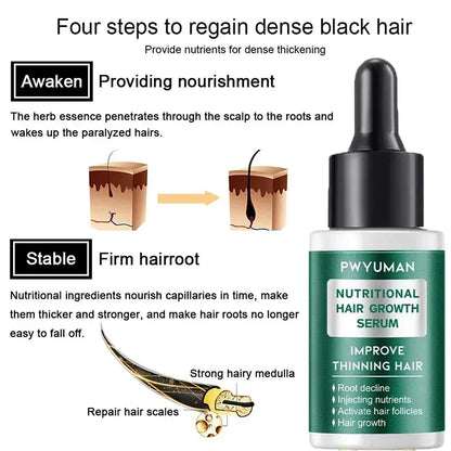 7 Days Ginger Hair Growth Serum Fast Promote Hair Regrowth Products Anti Hair Loss Repair Scalp Baldness Nourish Hair Root Care