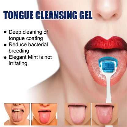 Tongue Coating Cleaning Gel Mint Tongue Scraper Scrubber Orasl Care Removal Odor Health Fresh Breath Care Dental Hygiene Tool