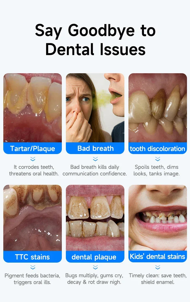 Ultrasonic Electric Dental Scaler High Frequency Vibrating Teeth Cleaner Plaque Calculus Tartar Stains Remover 5 modes with LED