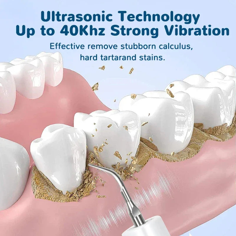 2026 Ultrasonic Tooth Cleaner Dental Scaler Calculus Remover Plaque Tartar Eliminator Dental Stone Removal Teeth Cleaning Tools