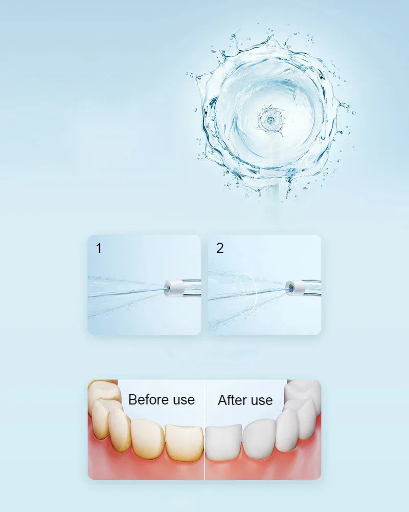 New MIJIA Portable Oral Irrigator F300 Dental Water Jet Water Flosser Teeth Whitening Bucal Tooth Cleaner Waterpulse MEO703