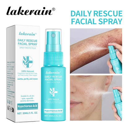 Hypochlorous Acid Spray Toner for Face Helps Reduce Redness Breakouts Soothing pH Balancing Toner Skincare