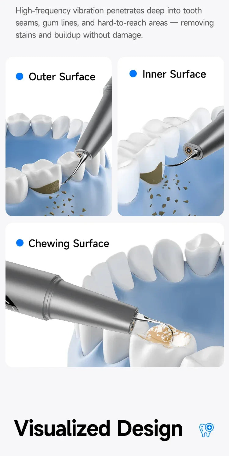 CURVY MOON Visible Electric Ultrasonic Tooth Cleaner with Camera Tartar Remover Tooth Stain Cleaning Tools Teeth Whitening Care