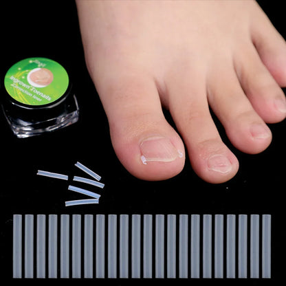 1-10 Box Elastic C-shaped Tube Padding Treatment Foot Care Invisible Groove Straightening Clip Ingrown Toenail Corrector Tools