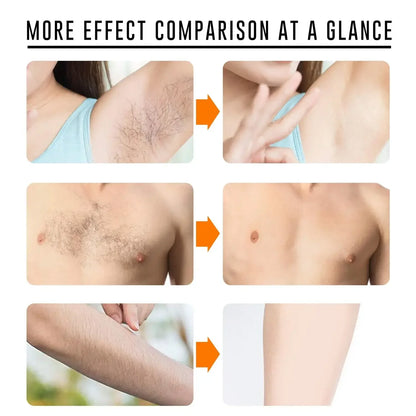 Sakura Hair Removal Cream Fast Painless Hair Growth Inhibitor Arm Armpit Legs Intimate Areas Permanent Depilatory for Men Woman