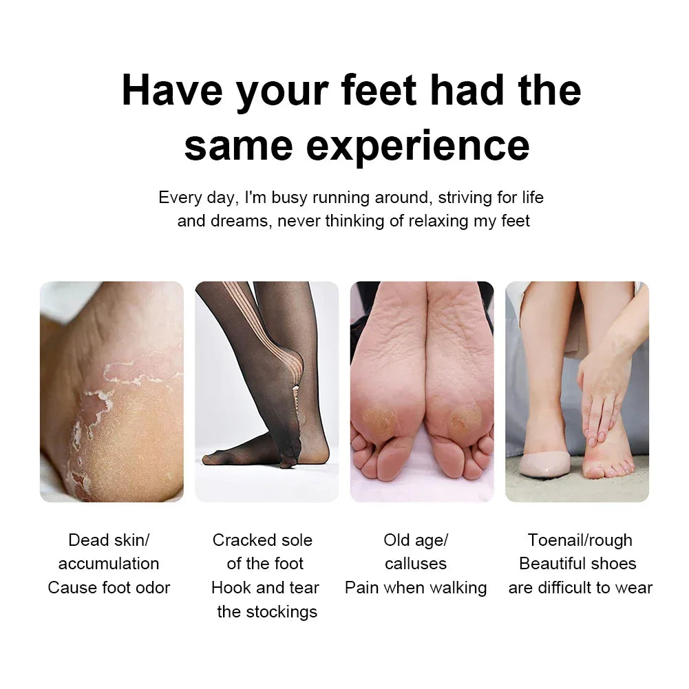 Electric Foot Callus Remover Rechargeable Electric Callus Remover Feet Care Electric Foot File for Feet