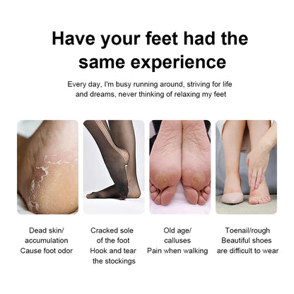 Electric Foot Callus Remover Rechargeable Electric Callus Remover Feet Care Electric Foot File for Feet
