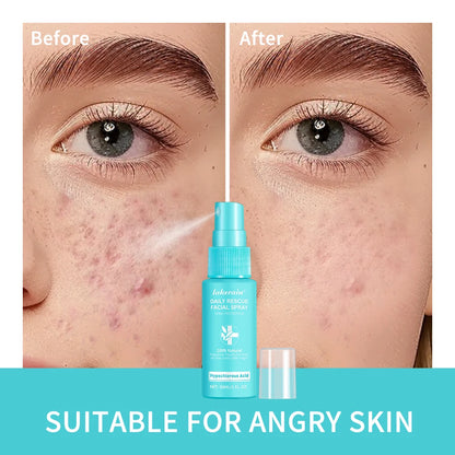 Hypochlorous Acid Spray Toner for Face Helps Reduce Redness Breakouts Soothing pH Balancing Toner Skincare