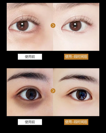 Skincare Products 24K Gold Hyaluronic Acid Eye Mask Remove Dark Eye Circles Collagen Eye Patches Korean Face Care Product