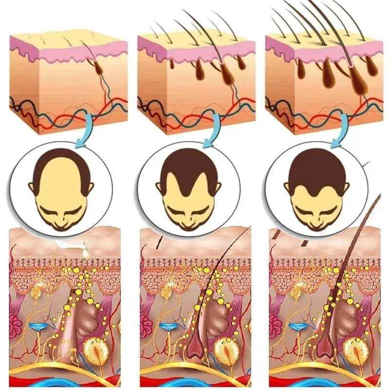7 Days Ginger Hair Growth Serum Fast Promote Hair Regrowth Products Anti Hair Loss Repair Scalp Baldness Nourish Hair Root Care
