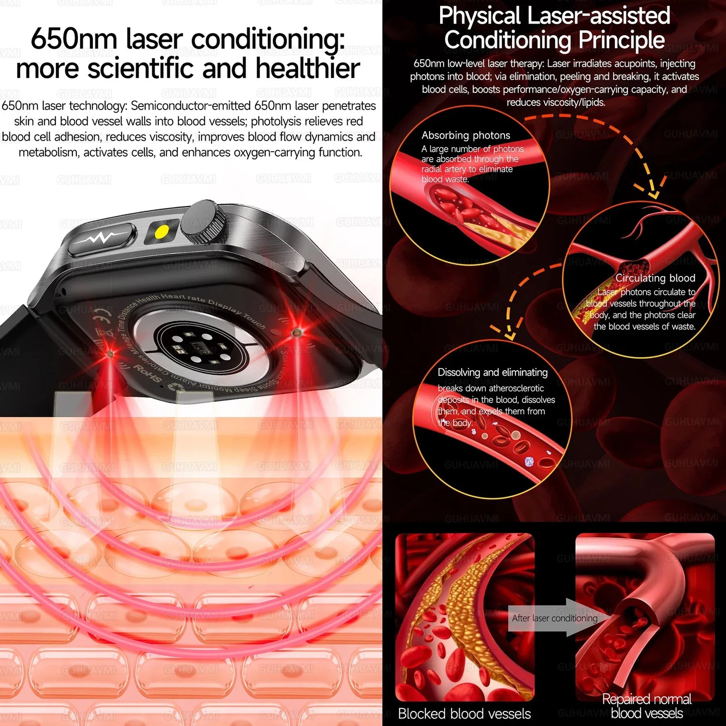 New 650nm Dual probe laser Health Smart Watch ECG+PPG Blood pressure Uric Acid Blood lipids AMOLED Physical therapy Smartwatches