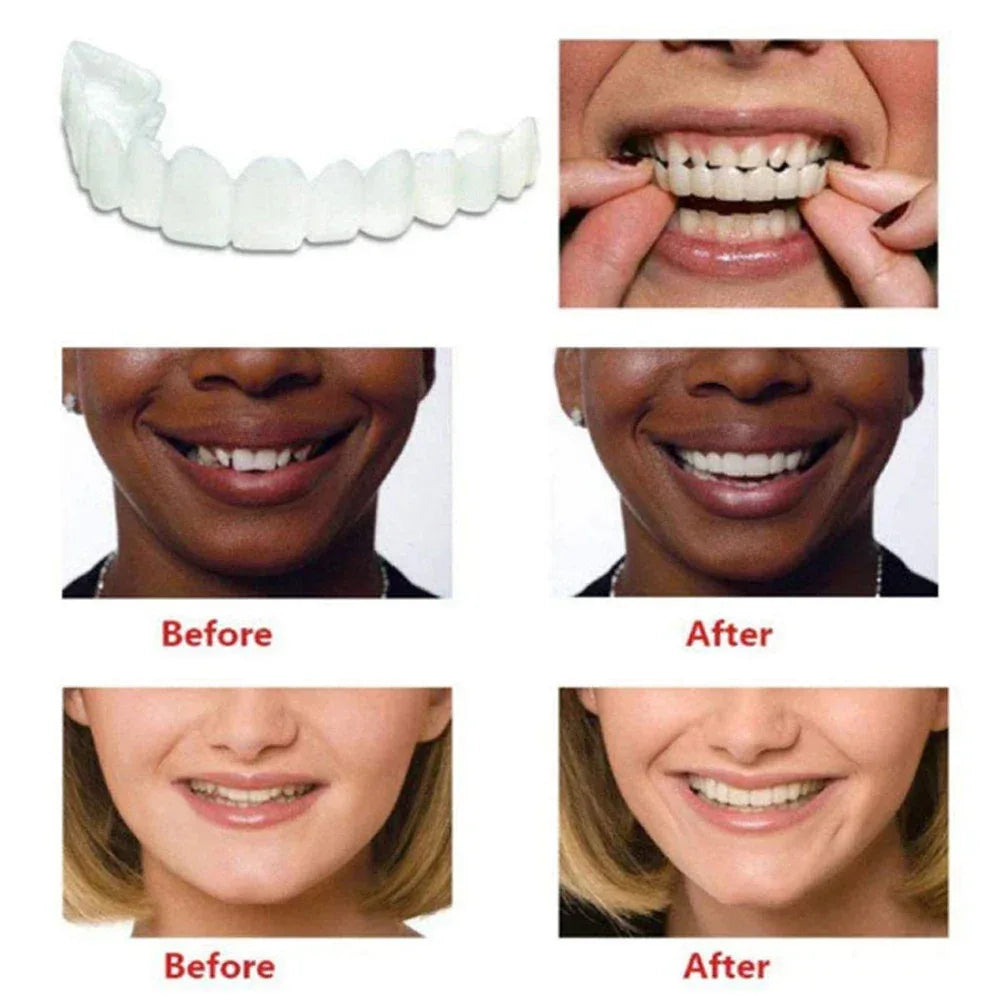 2 Pairs Smile Whitening Teeth Snap On Silicone Cosmetic Denture Upper and Lower Fake Tooth Cover Perfect Fit Teeth Beauty Tool