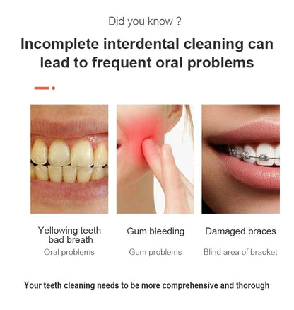 Professional wireless dental floss cleaner, 4 cleaning modes, portable rechargeable electric dental floss oral irrigator