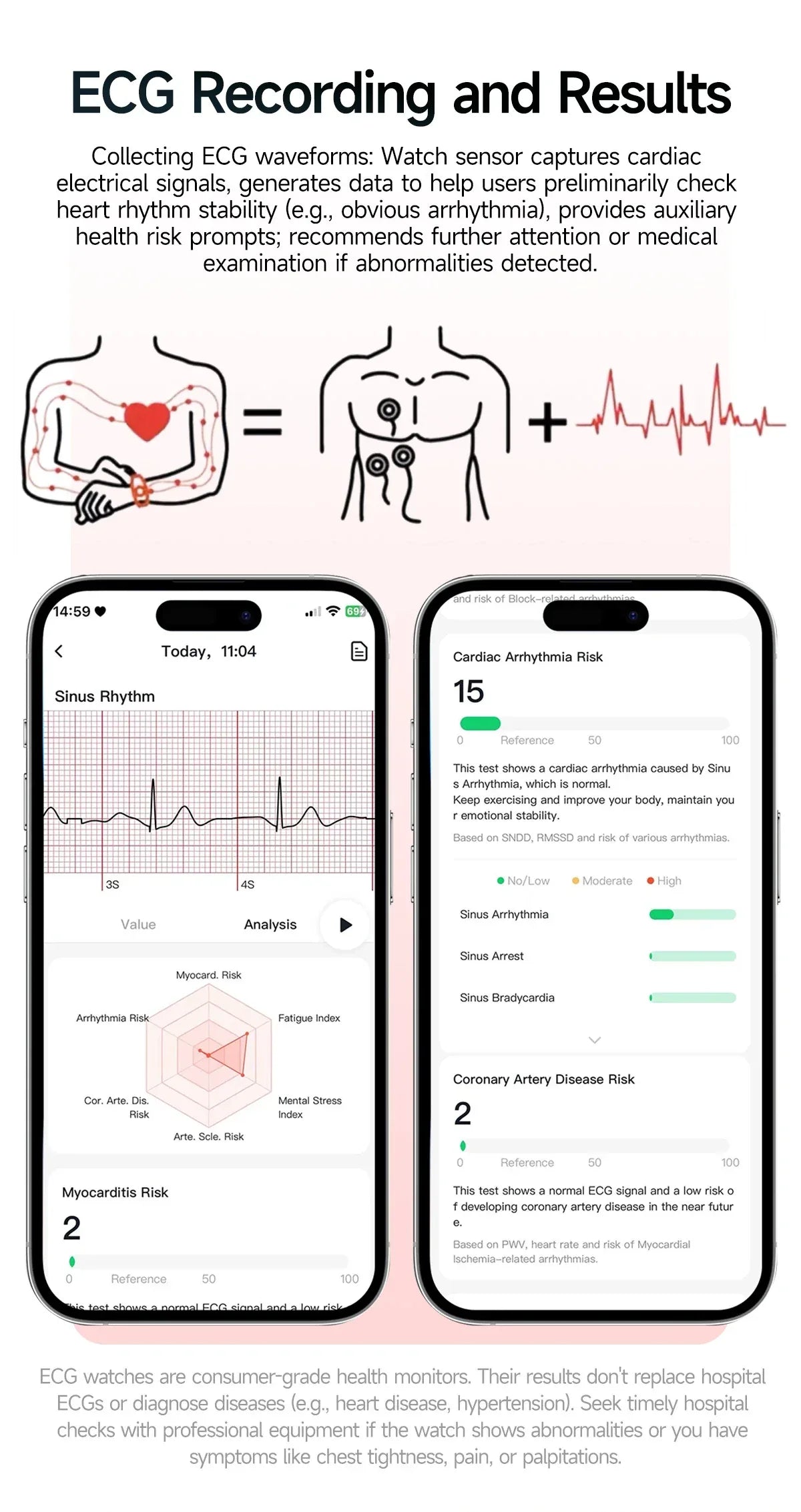2026 New Health Smart Watch Precise Measurement ECG+PPG Blood Pressure Uric Acid Body Fat Analysis call SmartWatch For Men Women