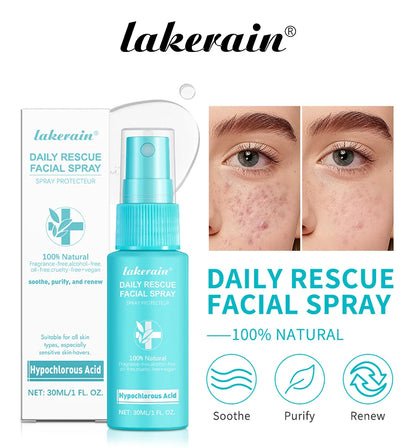 Hypochlorous Acid Spray Toner for Face Helps Reduce Redness Breakouts Soothing pH Balancing Toner Skincare
