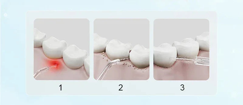 New MIJIA Portable Oral Irrigator F300 Dental Water Jet Water Flosser Teeth Whitening Bucal Tooth Cleaner Waterpulse MEO703