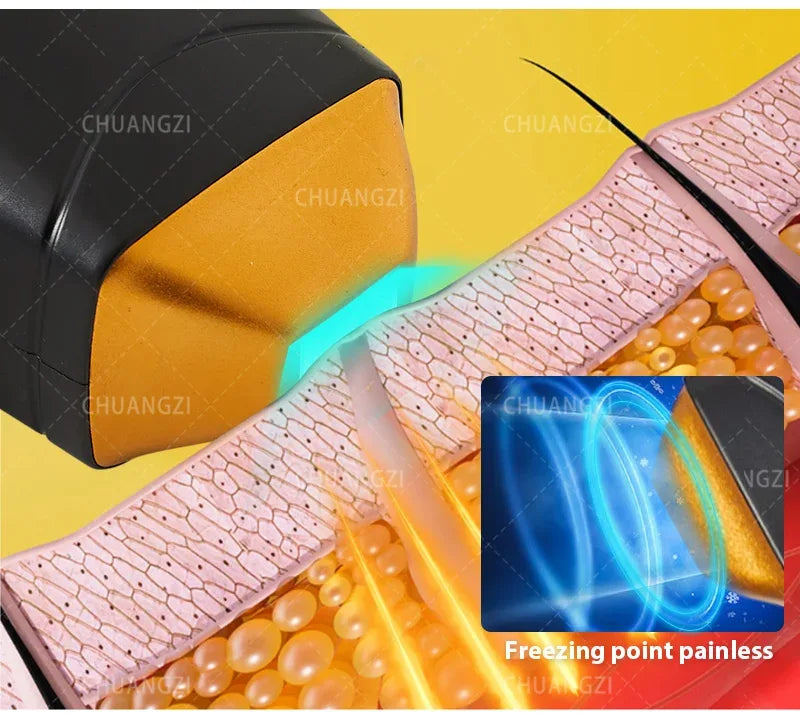 4000W Ice Point Painless 808nm laser Permanent Hair Removal Device 4 Wavelength Semiconductor Laser Full Body Custo