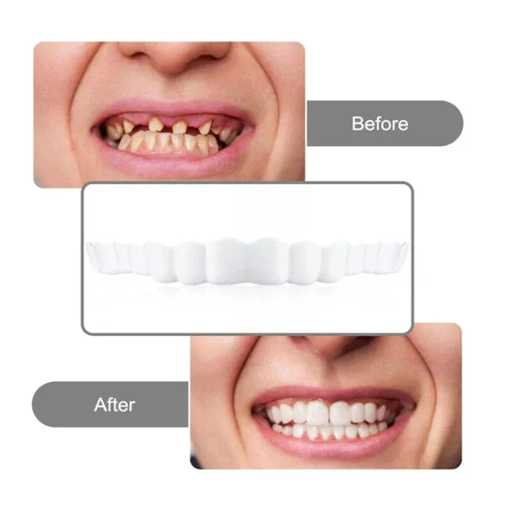 2 Pairs Smile Whitening Teeth Snap On Silicone Cosmetic Denture Upper and Lower Fake Tooth Cover Perfect Fit Teeth Beauty Tool