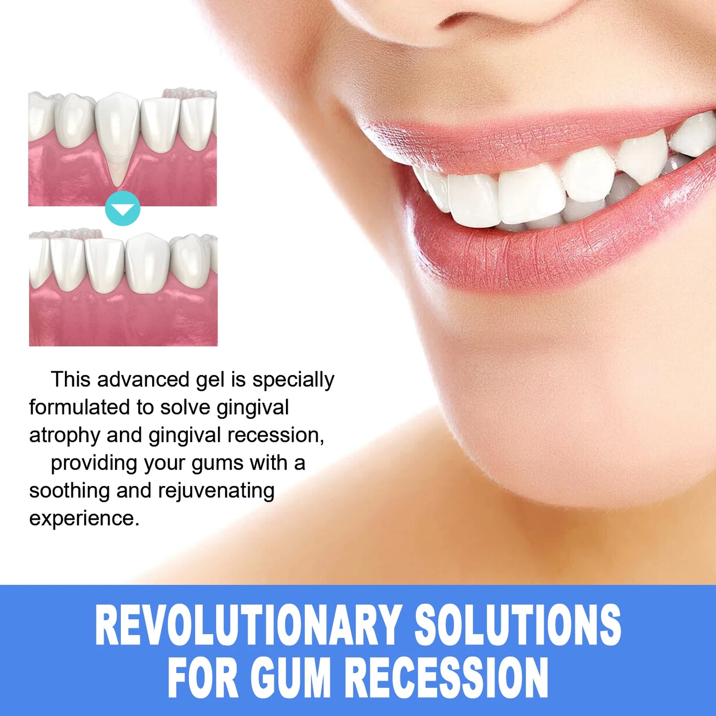 Damaged Gum Repair Care Gel Deep Cleaning Effectively Removes Yellow Teeth Stains Tartar Fresh Breath Teeth Cleaning Gel 4ml