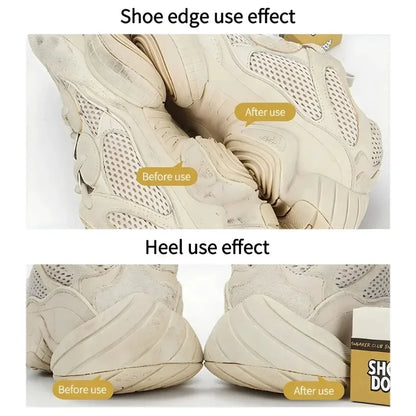 Shoe Cleaning Eraser Set - Stain Remover, Brush Included, Ideal for Sneakers & General Decontamination