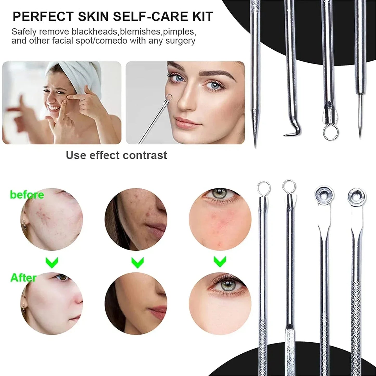 4Pcs Blackhead Remover Acne Needle Facial Cleansing Acne Extractor Remove Blackhead Pores Cleaning Tools