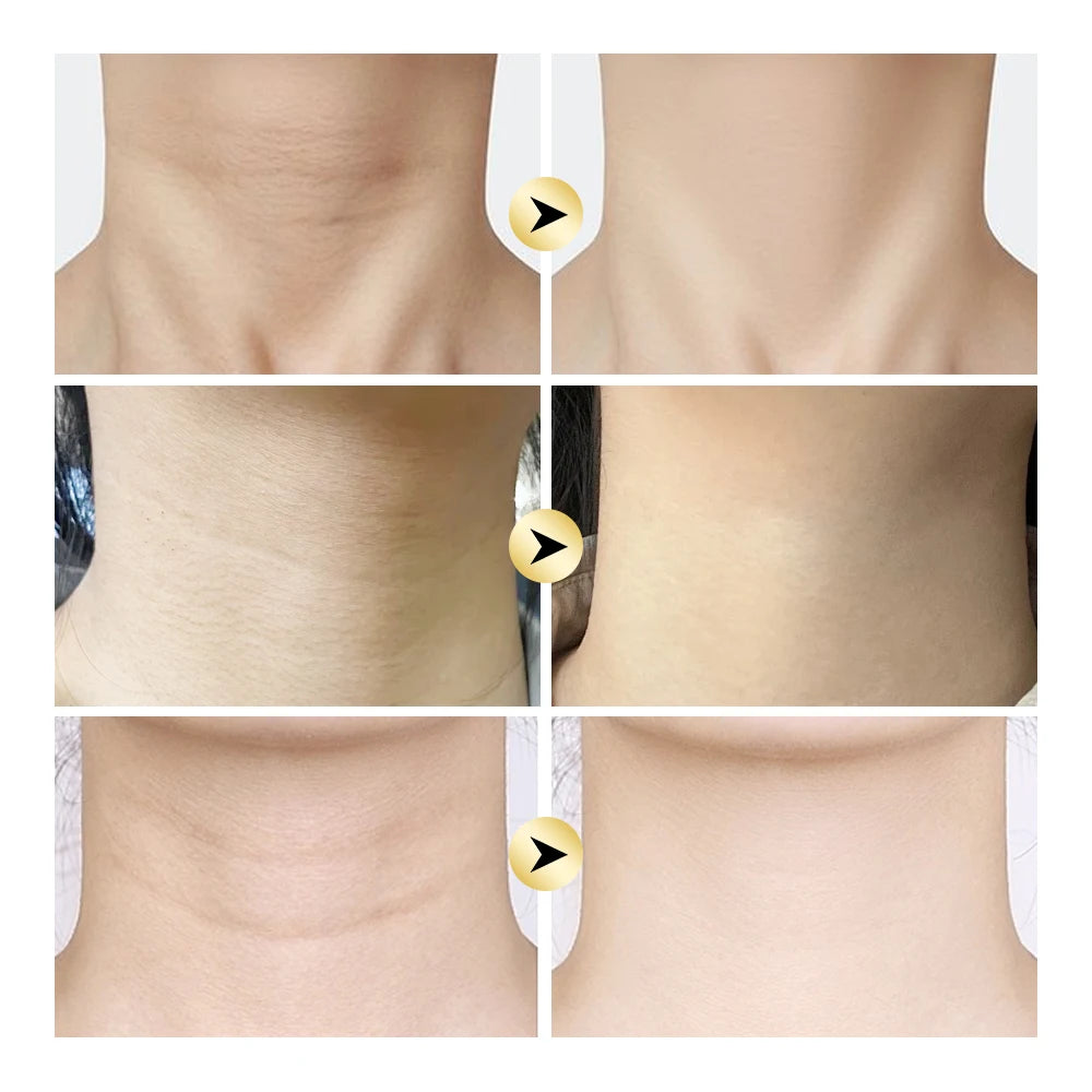 Ah-8 Firming Neck Cream for Crepey Skin Body Care Comfort Tighten Neck Cream Ah-8 Moisturizing & Tightening Lotion Cosmetic Skin