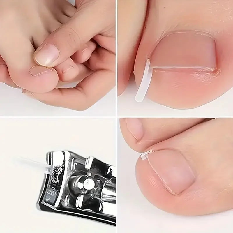 1-10 Box Elastic C-shaped Tube Padding Treatment Foot Care Invisible Groove Straightening Clip Ingrown Toenail Corrector Tools